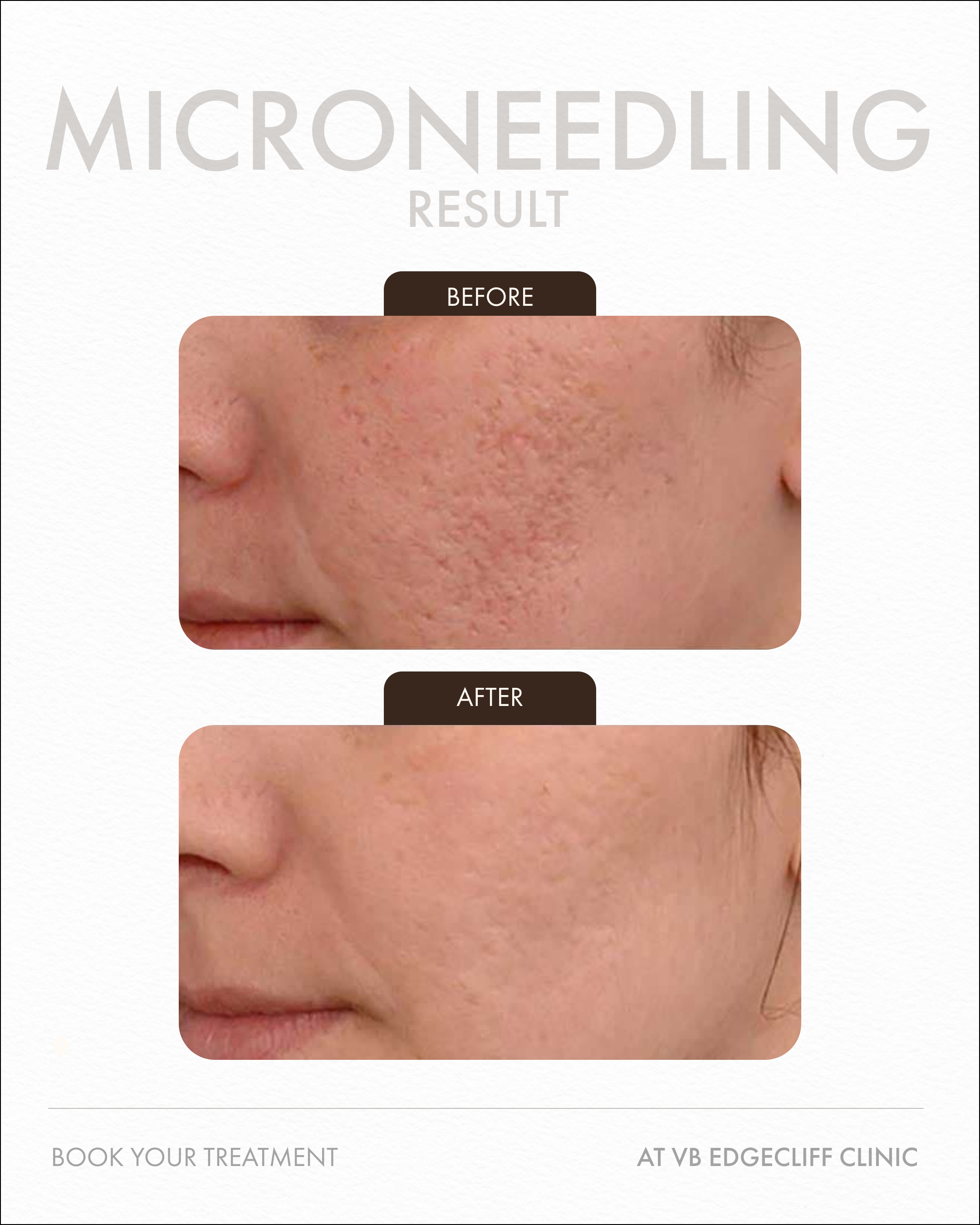 Close up of clean, healthy looking skin in a professional clinical setting